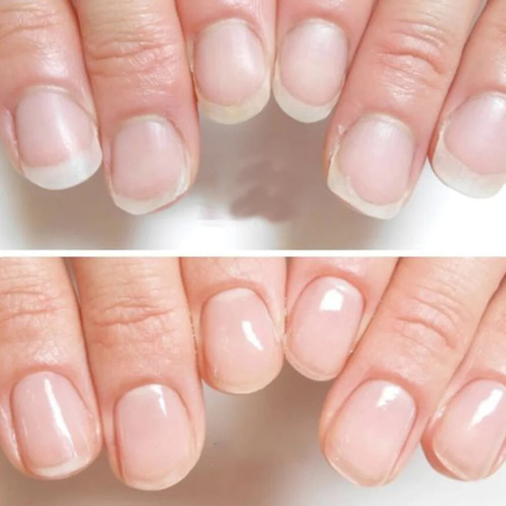Tinovo Uno Natural Nail Growth Complex 9 in 1 Nail Art Treatment Therapy for Repair Care Thin Brittle Nails Top Coat Hardener
